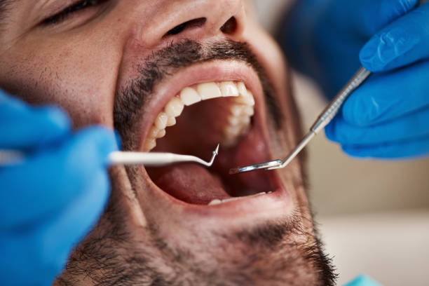 Best Dental Abscess Treatment in Sunset, UT